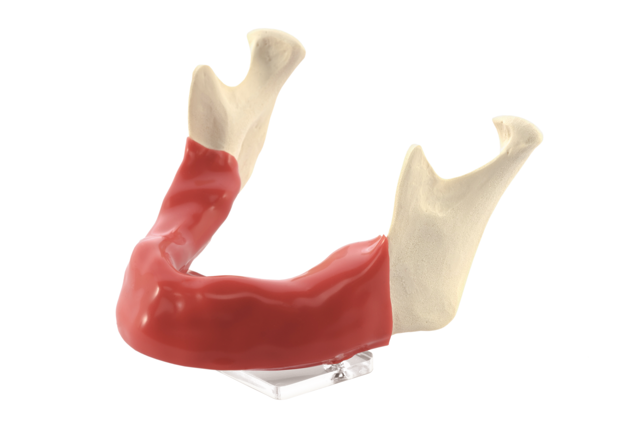 Mandibula A1 mucosa